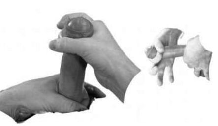 Esguince des Penis, um ihn zu erhöhen